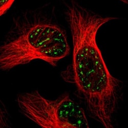 BRD1 Antibody, Novus Biologicals 25 &mu;L; Unlabeled:Antibodies, Polyclonal